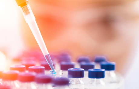 Blog Researcher Woman Pipetting Samples Blue