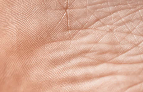 Blog Skin Closeup