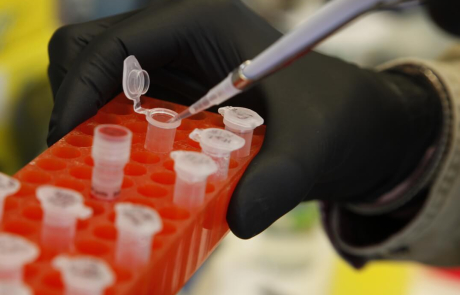 Blog Main Image - BRI Researcher Pipetting Samples 1