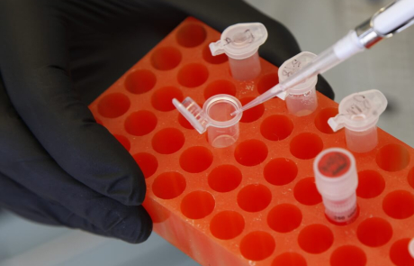 Blog BRI Researcher Pipetting Samples 2