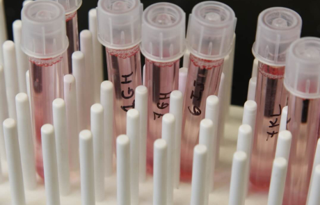 Blog Main Image - BRI Samples Vials Pink