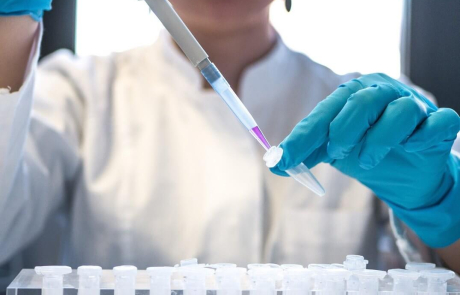 Blog Researcher Woman Pipetting Samples Lab 2