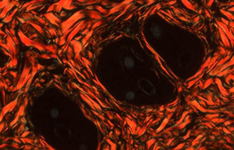 Blog Scientific Collagen Fibers Skin
