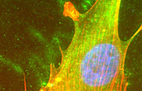 Blog Scientific Hyaluronan Extracellular Matrix