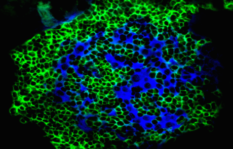 Blog Scientific T1D Humanized Mice