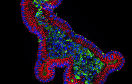 Blog Scientific Mouse Small Intestine Organoid 1