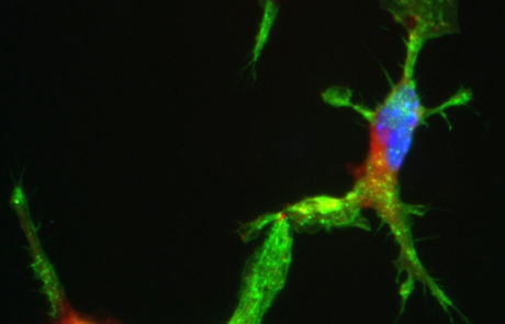 Blog Main Image - Scientific Star Shaped Monocytes