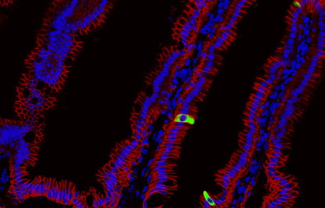 Blog Scientific Tuft Cells In Mouse Small Intestine