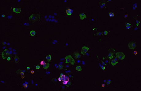 Blog James Lab T1D Beta Stem Cells