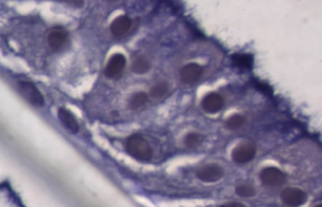Blog Scientific Lung In Dish