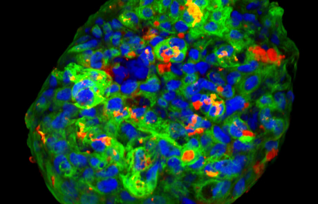 Blog Scientific Type 1 Diabetes (T1D) Islet Organoid