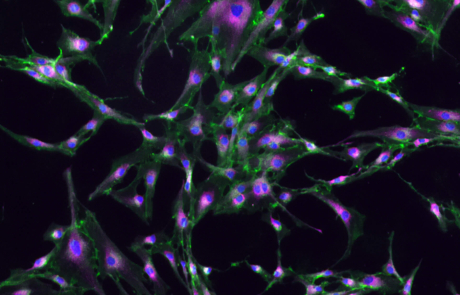 Purple shows the cell's mitochondria, green colors the cell membranes, and blue is the nucleus. Imaged by Mitch Fahning.