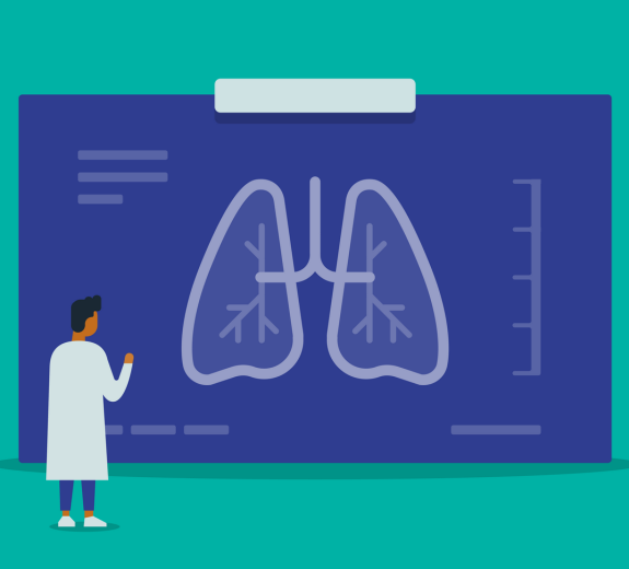 Blog Main Image - 2D Abstract Doctor Examining Giant Chest X-Ray