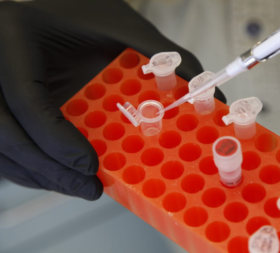 Blog Main Image - BRI Researcher Pipetting Samples 2