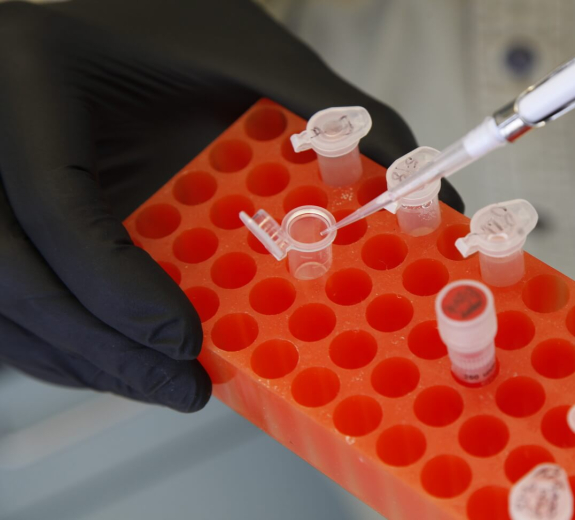Blog BRI Researcher Pipetting Samples 2