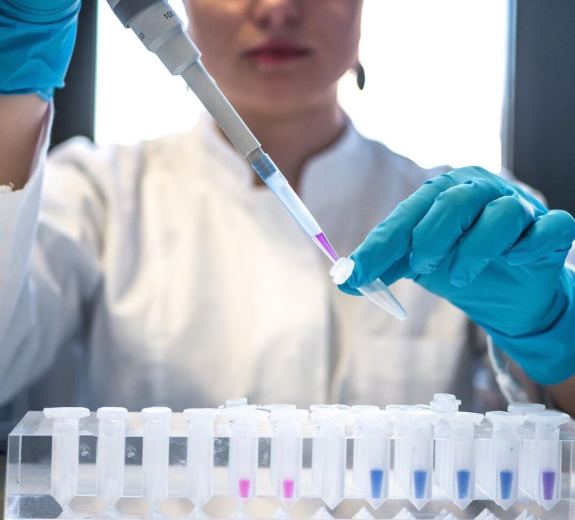 Blog Main Image - Researcher Woman Pipetting Samples Lab 2