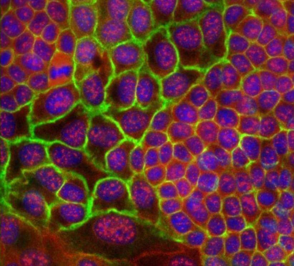 Blog Main Image - Scientific Cells Mammary Gland Cancer Associated Molecules