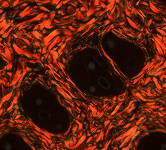 Blog Scientific Collagen Fibers Skin