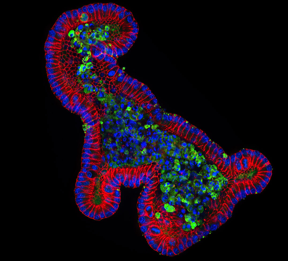 Blog Scientific Mouse Small Intestine Organoid 1