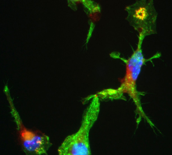Blog Main Image - Scientific Star Shaped Monocytes