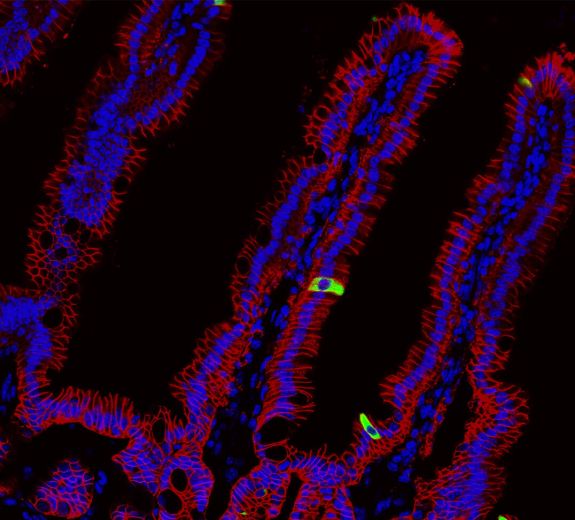 Blog Scientific Tuft Cells In Mouse Small Intestine