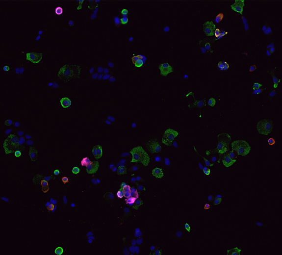 Blog Main James Lab T1D Beta Stem Cells