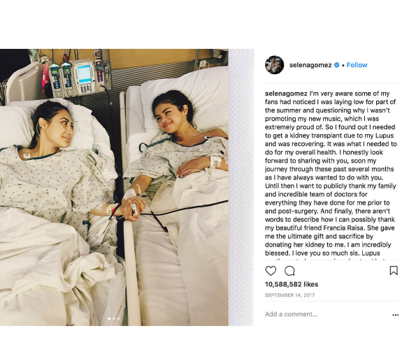Featured - Selena Gomez Lupus IG