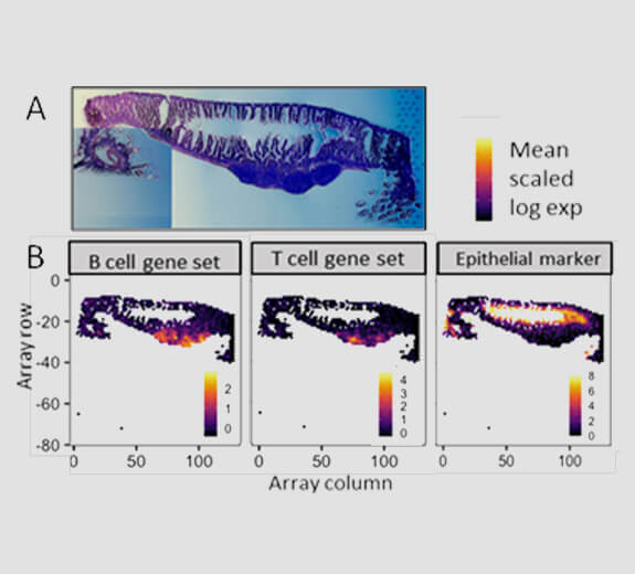 Featured 2D Data Spatial Transcriptomics Charts