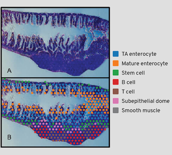 Featured Layout 2D Data Spatial Transcriptomics Dual Pane