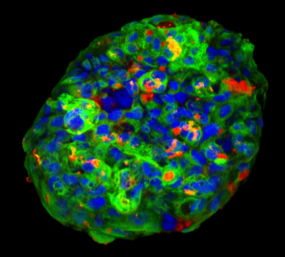 Blog Scientific Type 1 Diabetes (T1D) Islet Organoid