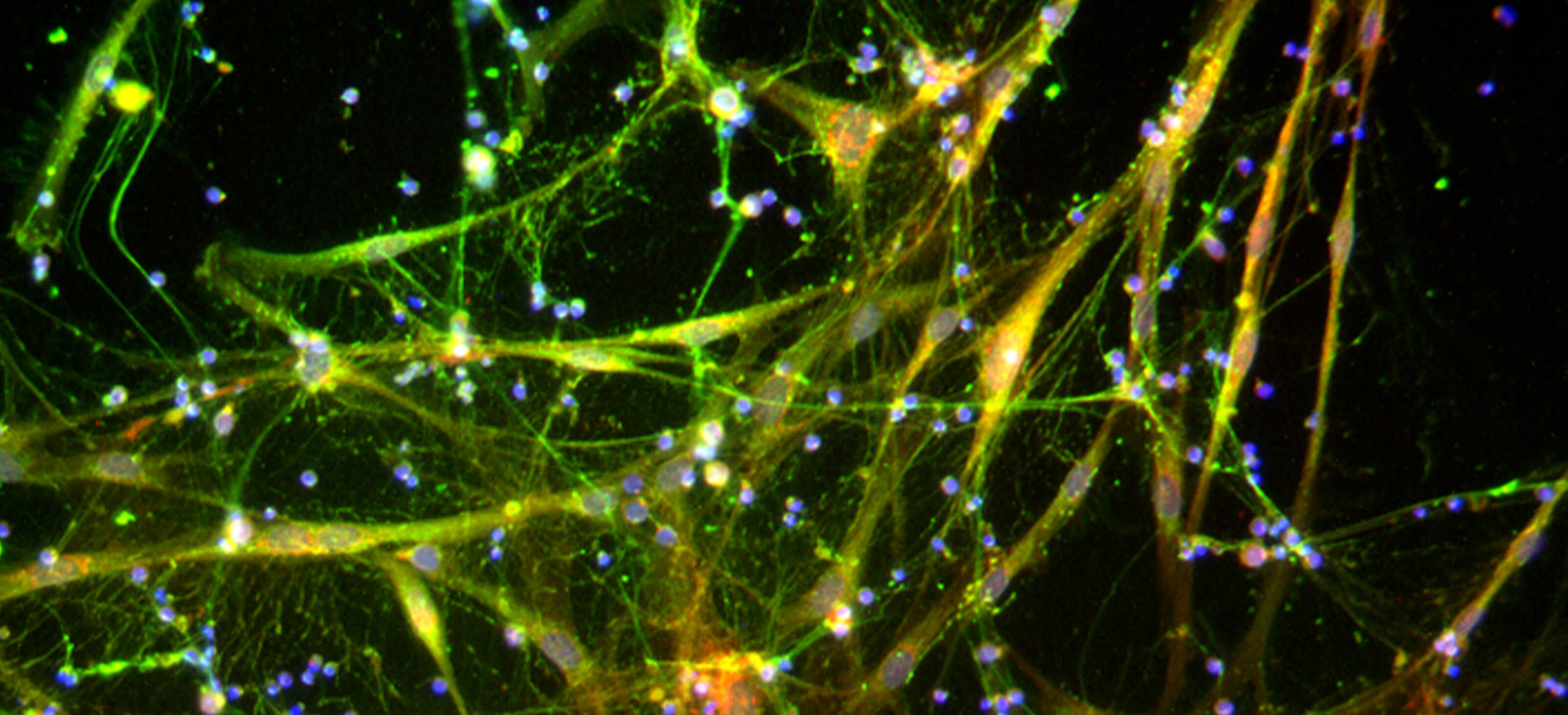 Full-Width - Scientific Human Fibroblasts in a co-culture system