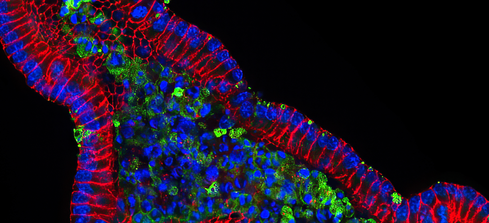 Full-Width - Scientific Mouse Small Intestinal Organoid