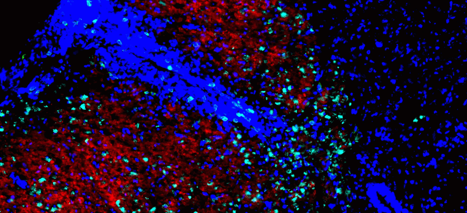 Full-Width - Scientific Spinal Cord of EAE Affected Mouse