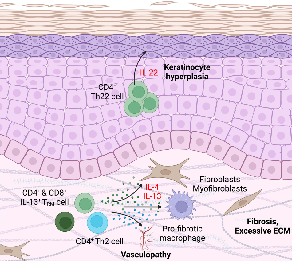 Morawski Research Project Inline - Skin T Cells Structure