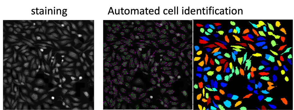 Stefani Research Project Inline - Staining Segmentation