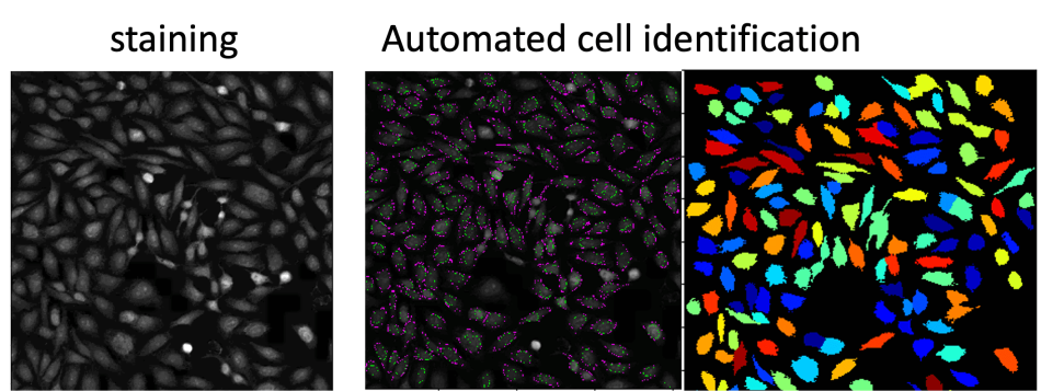 Stefani Inline - Staining Segmentation