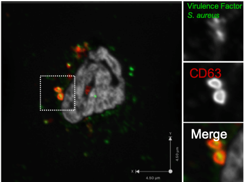 Lacy-Hulbert Res Proj Inline - Distinguishing Pathogens from Self