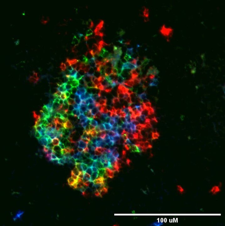 Ziegler Research Project Inline - Regulation of Humoral