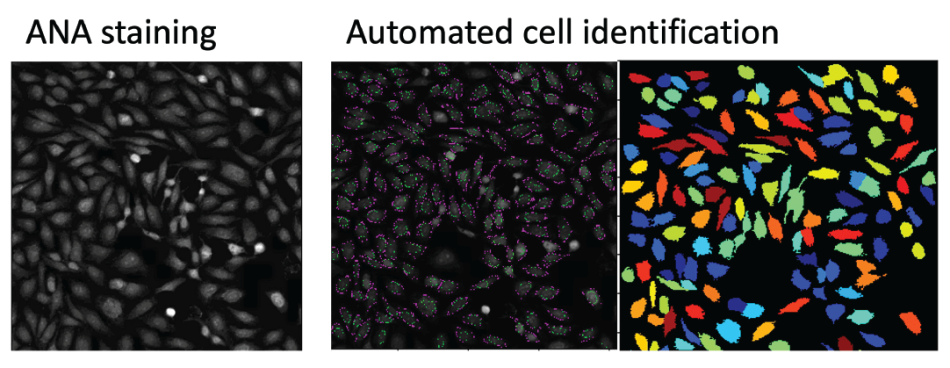 Graphic Layout 2D Data ANA Staining
