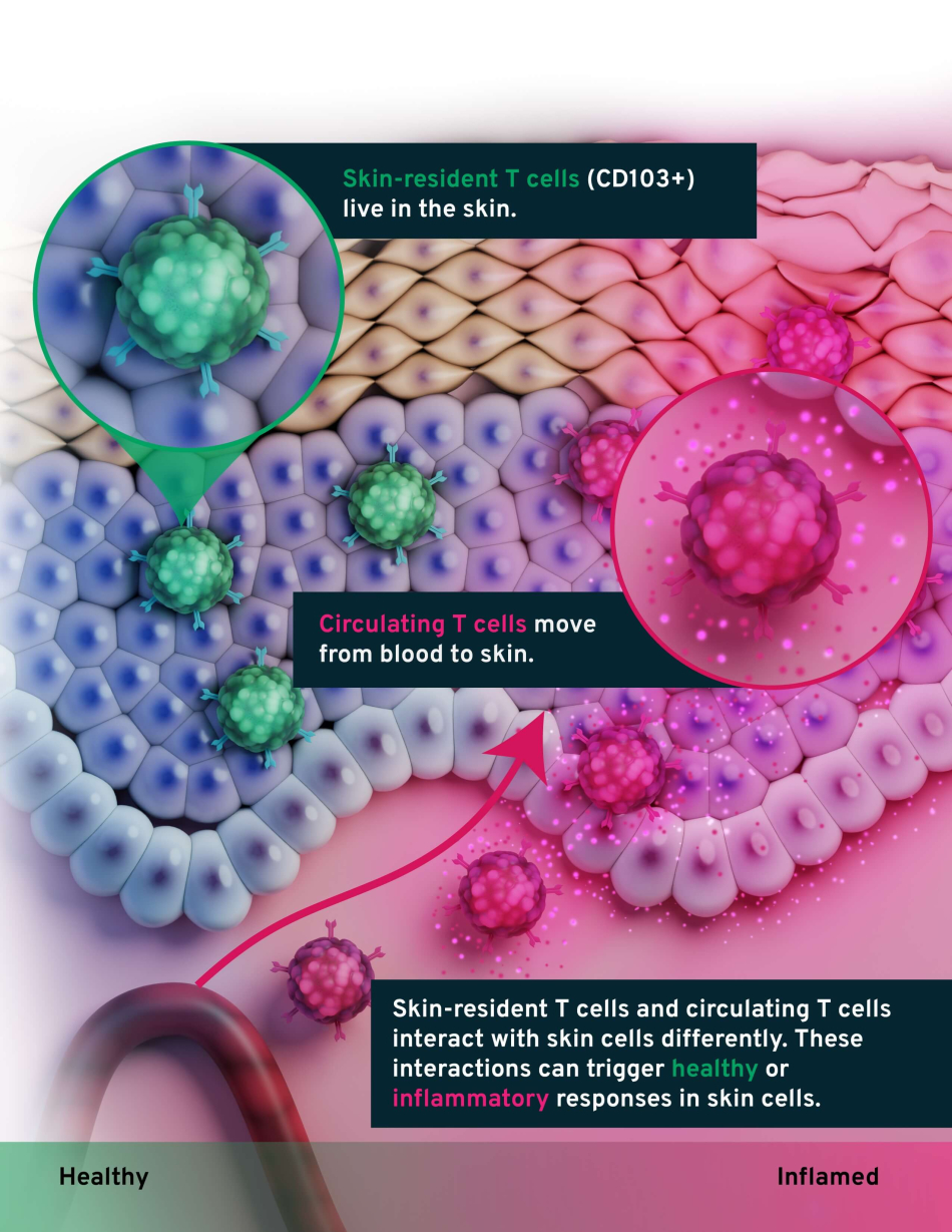 Skin-Resident and Circulating T Cells in Skin Health