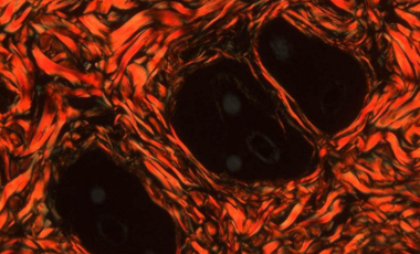 Blog Scientific Collagen Fibers Skin