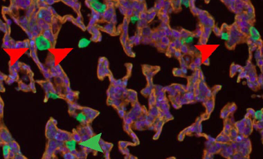 Hamerman Research Project Preview - Flightless-1 in lung macrophage and DC development and function