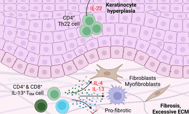 Morawski Res Proj Prev - Skin T Cells Structure