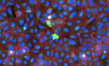 Stefani Research Project Preview - Cellular Response to Stress Signals 