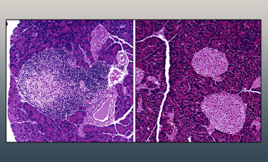 Campbell Lab Res Proj Prev - IL-2 Mutein Therapy