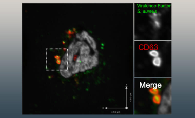 Lacy-Hulbert Research Project Prev - Distinguishing Pathogens from Self