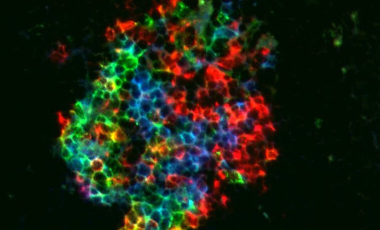 Ziegler Research Project Preview - Regulation of Humoral