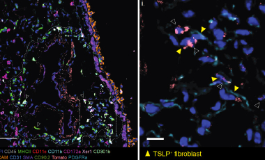 Ziegler Res Proj Prev - Role of TSLP and IL33