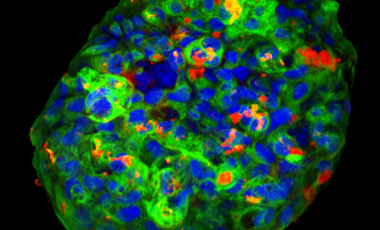 Blog Scientific Type 1 Diabetes (T1D) Islet Organoid