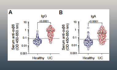 Lord Lab Research Project Preview - Understanding Role Autoantibodies in UC